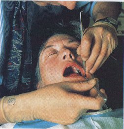 dental work - mouth open